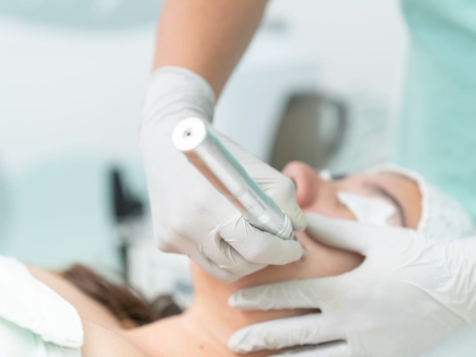 Summer Dermaplane Special at Beddington Beauty